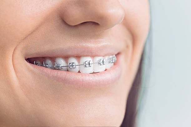 Best Invisalign and Clear Aligners  in Beach, ND